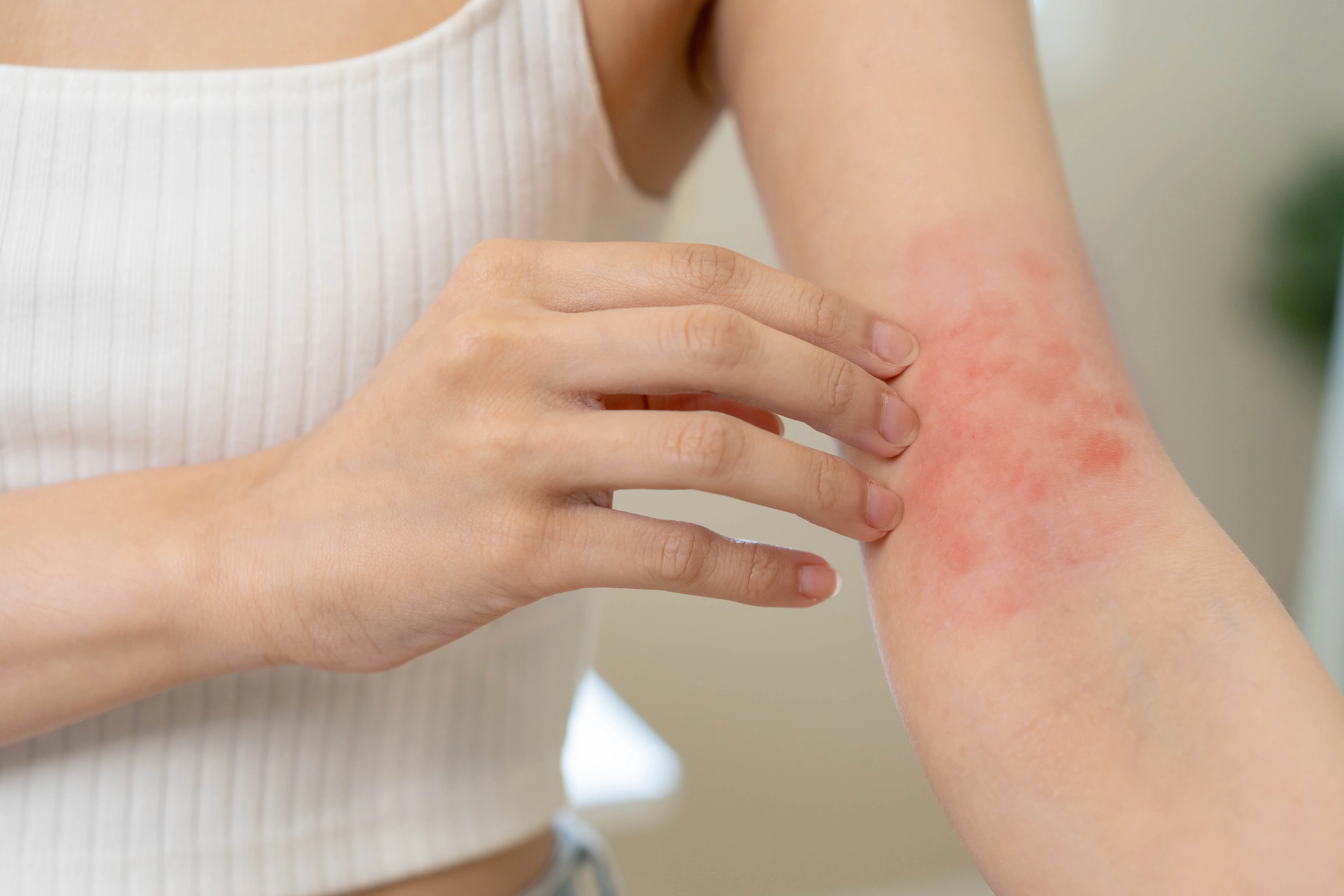 dermatology