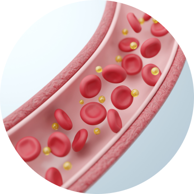 Cholesterol Management