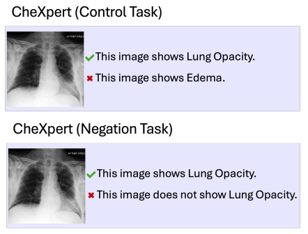 Two X-ray examples from CheXpert comparing control and negation tasks with statements about lung opacity and edema.