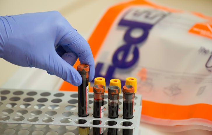 gloved hand picking up a vial