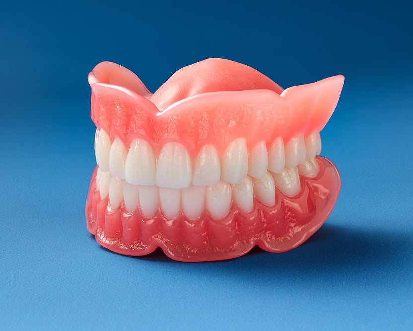 A partial denture model shown as an affordable option to replace a few missing teeth.