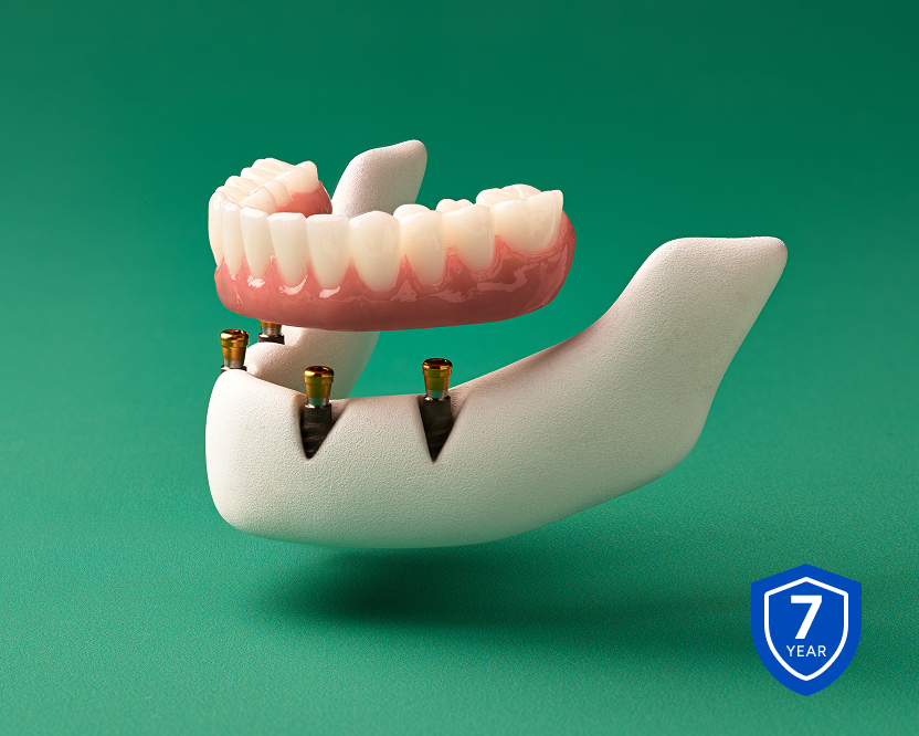 Fixed full arch dental implant model displayed above dental implants with a 10-year warranty badge.