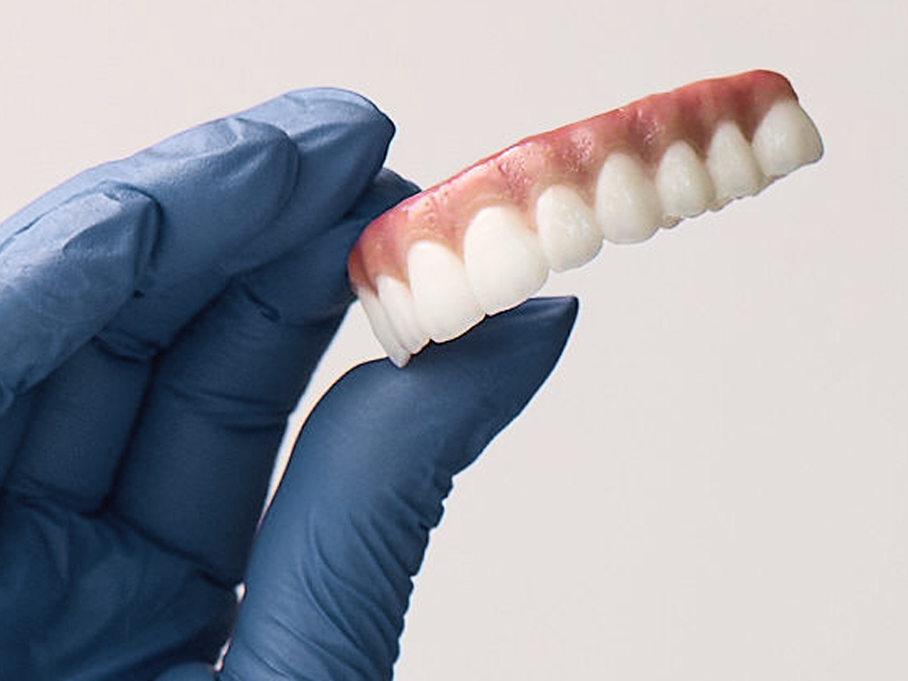 Close up of a ClearChoice lab technician using a rotary tool to custom finish a full-arch dental implant prosthesis