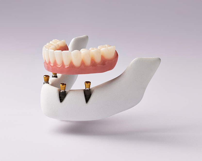 WB AD DentalServices-SpanishDesktopCard01 830x670 20260305