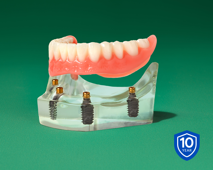 Alt text:
Fixed full arch dental implant model displayed above dental implants with a 10-year warranty badge.