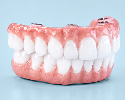 Close-up of the ultra-durable Endura zirconia dental arch