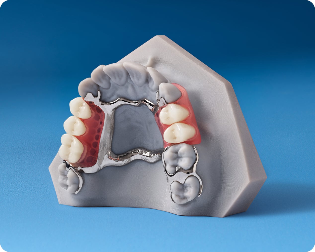 Partial Dentures