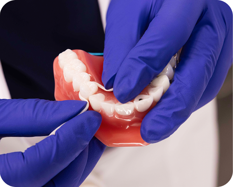 Alt text:
Dental professional using a floss threader to clean between teeth on a dental implant model.