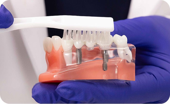 Dental professional brushing an implant bridge model.