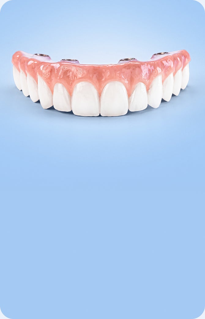 full arch dental implant prosthesis with natural-looking teeth and visible implant structure, representing endura arch full mouth dental implant solution