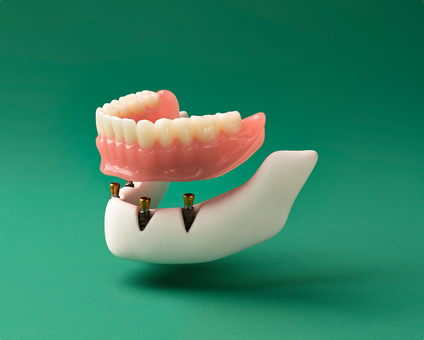 WB AD DentalServices-SpanishDesktopCard05 830x670 20260305