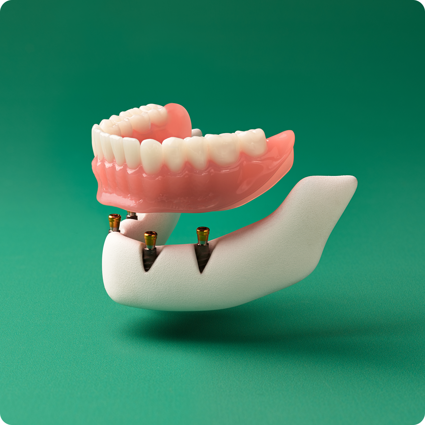 WB AD OnixSecureTradPdpDesktopHero03 1400x1400 20260607