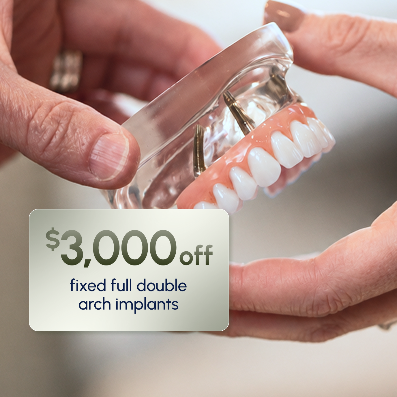 Close up of a fixed double arch dental implant model used for the ClearChoice denture trade-in program