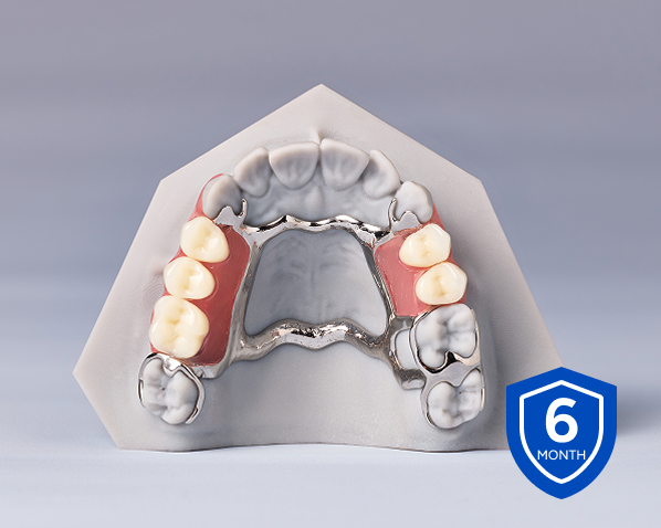 Upper partial denture with metal framework and acrylic base displayed with a 6-month warranty badge.