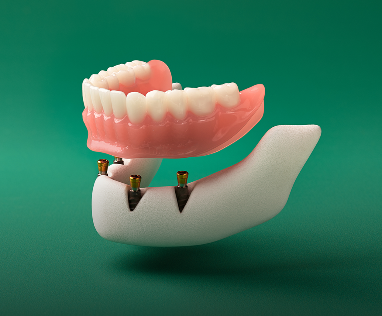 denturesnew
