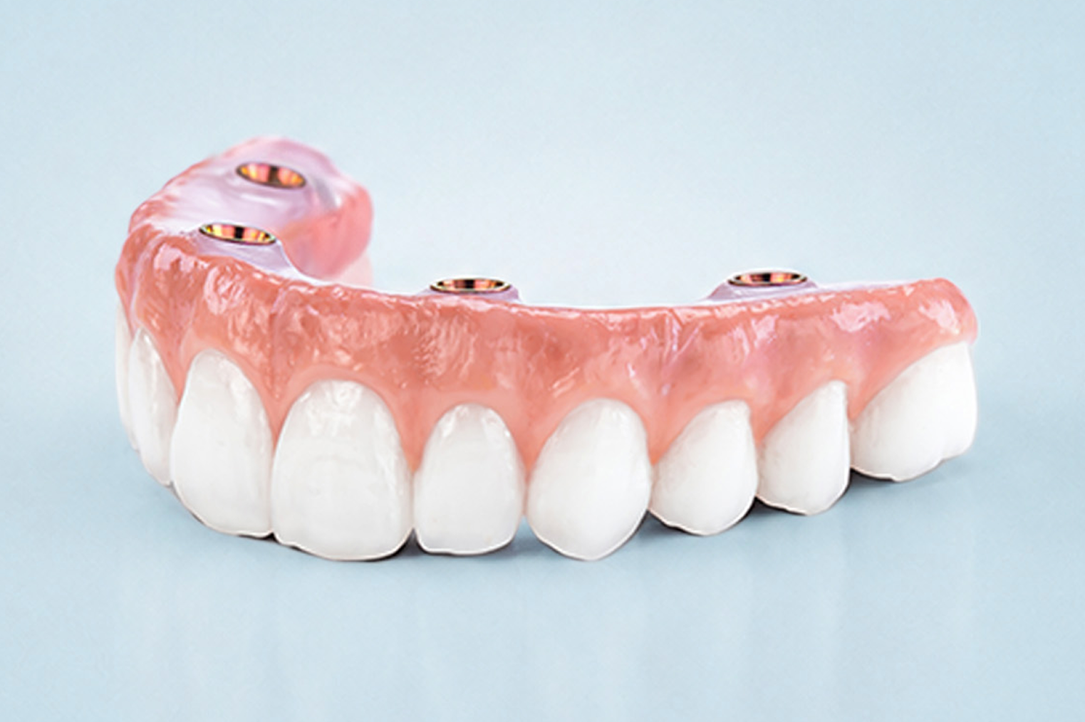ClearChoice Endura Elite arch fully customizable zirconia dental implant model