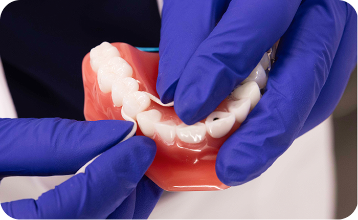 Alt text:
Dental professional using a floss threader to clean between teeth on a dental implant model.