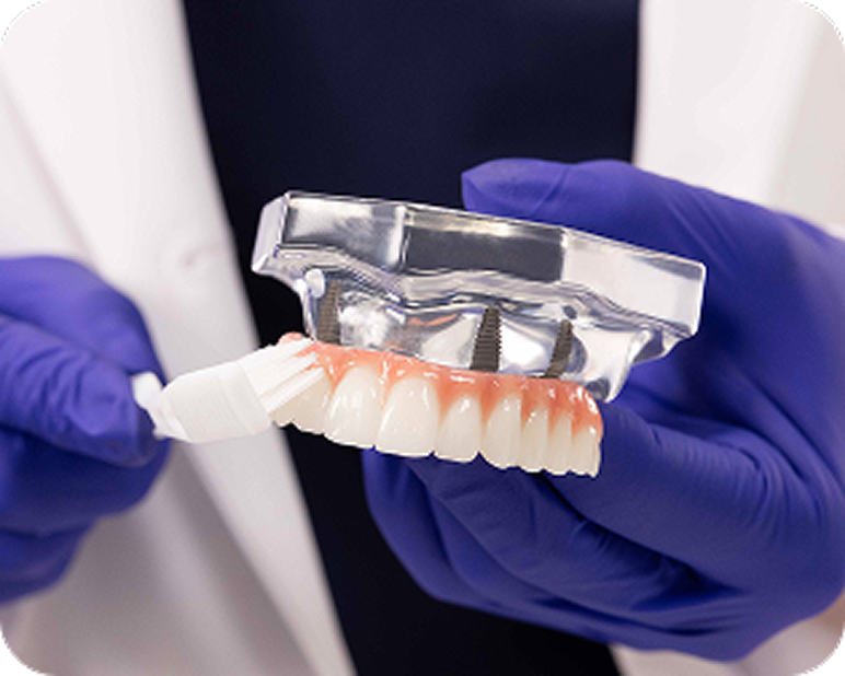 Alt text:
Dental professional cleaning a fixed full arch dental implant model.