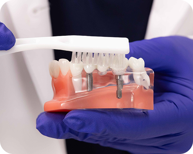 Alt text:
Dental professional brushing an implant bridge model.