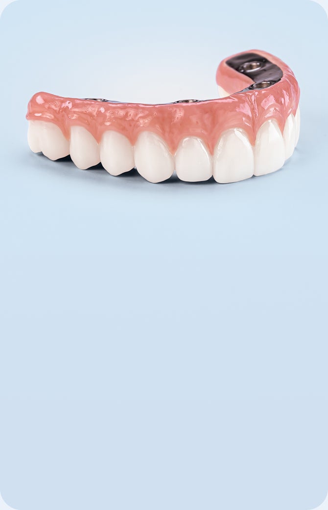 full arch dental implant prosthesis with natural-looking teeth and visible implant structure, representing essential full mouth dental implant solution