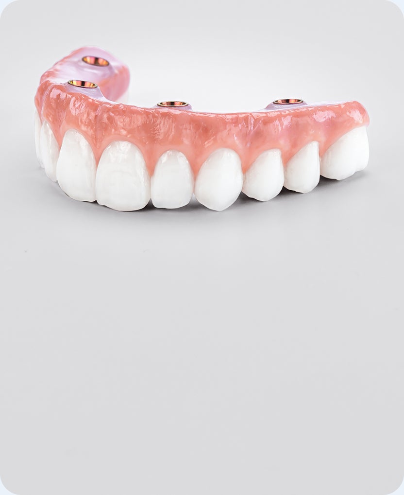 full arch dental implant prosthesis with natural-looking teeth and multiple implant connection points, representing premium elite full mouth dental implant solution
