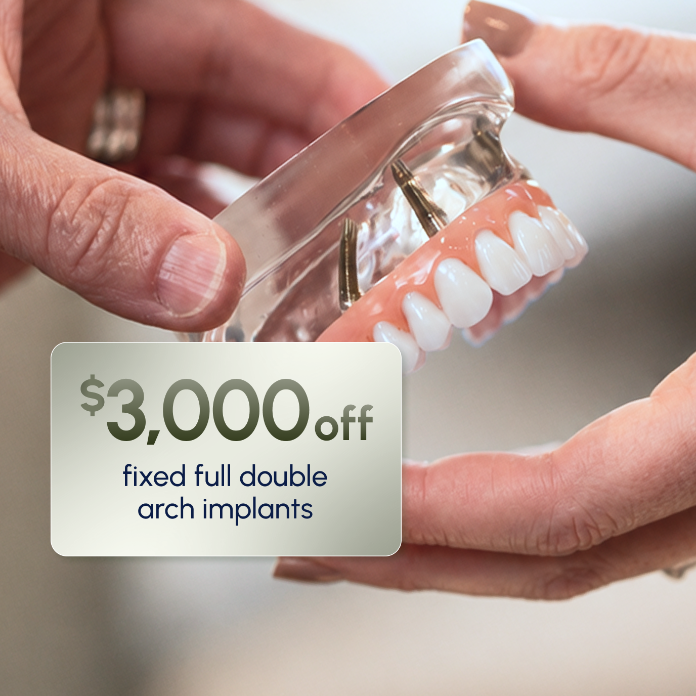 Close up of a fixed double arch dental implant model used for the ClearChoice denture trade-in program
