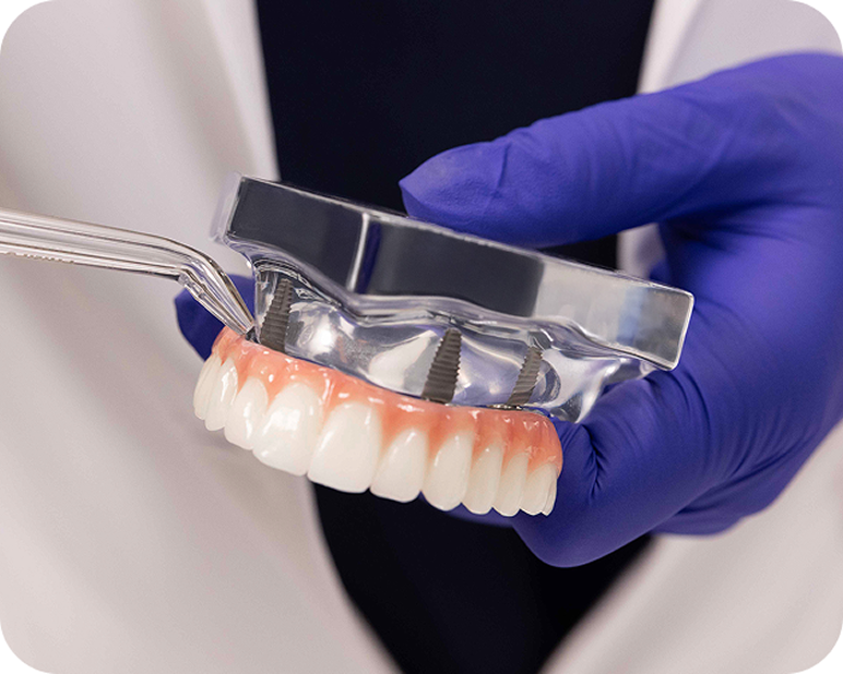 Alt text:
Dental professional flossing a fixed full arch dental implant model.