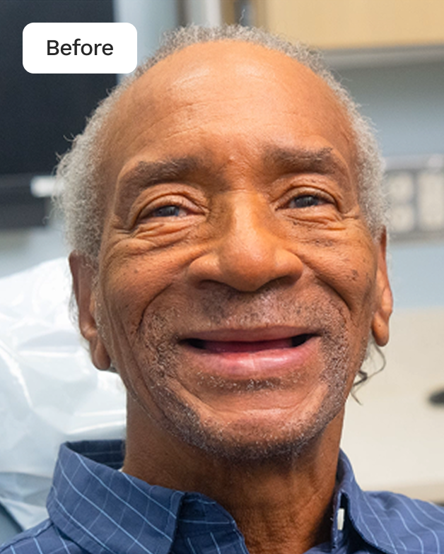 WB AD SignatureEliteDentures Before 20260123