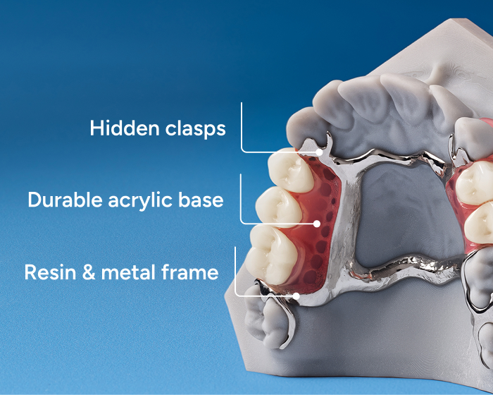 Labeled partial denture model showing hidden clasps, a durable acrylic base, and a resin and metal frame.