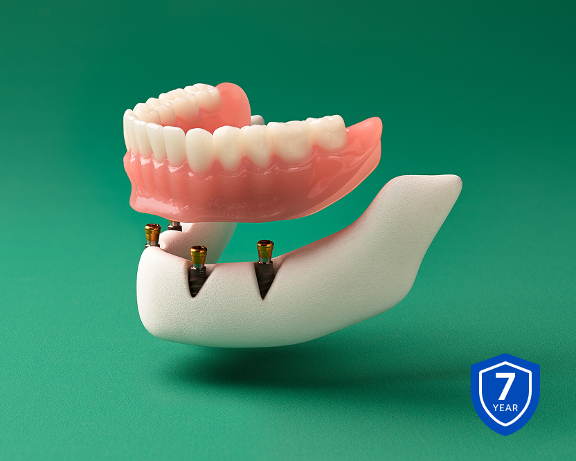Implant-supported denture model displayed above dental implants with a 7-year warranty badge.