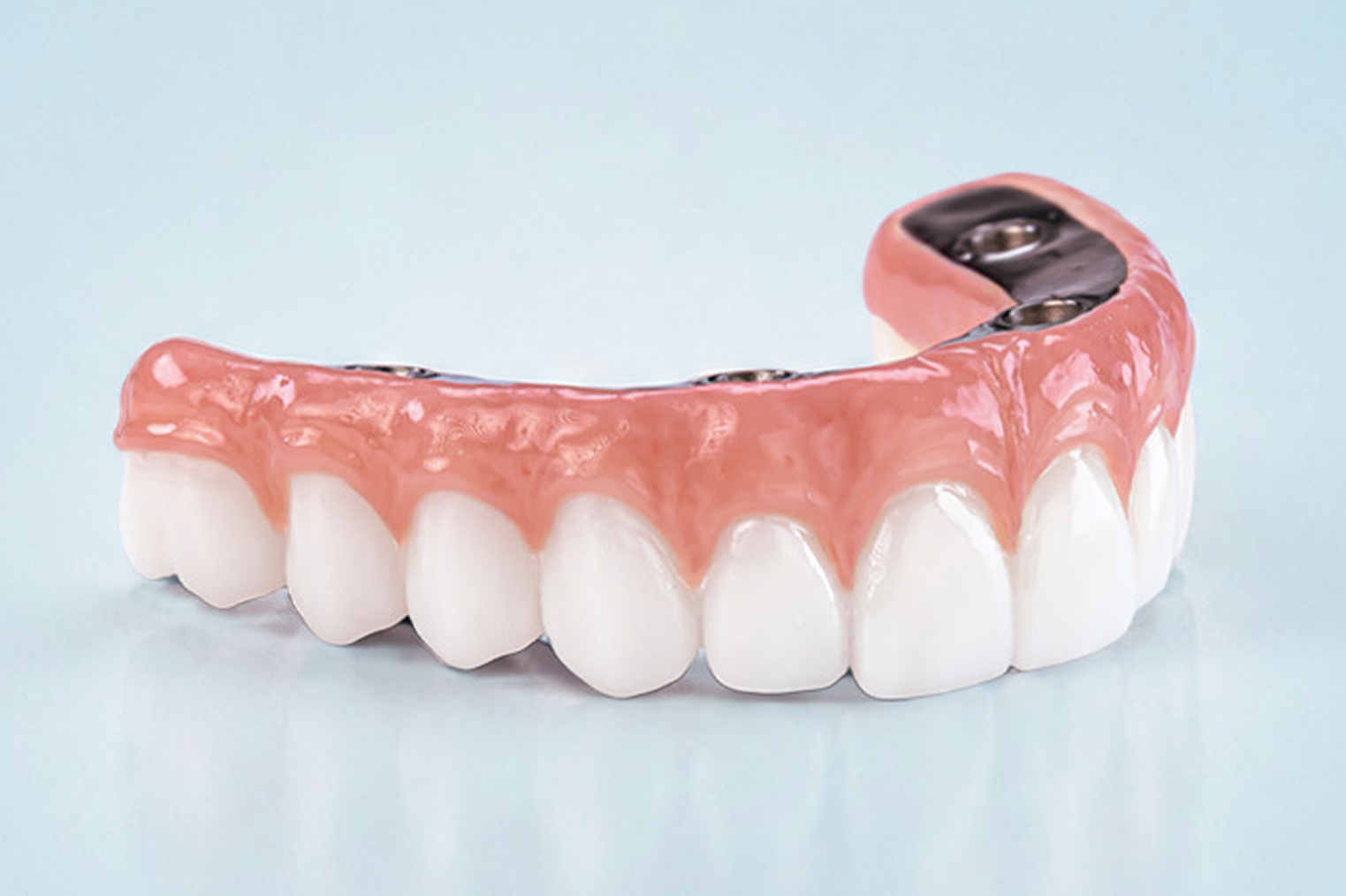 ClearChoice Essential arch affordable full arch dental implant solution