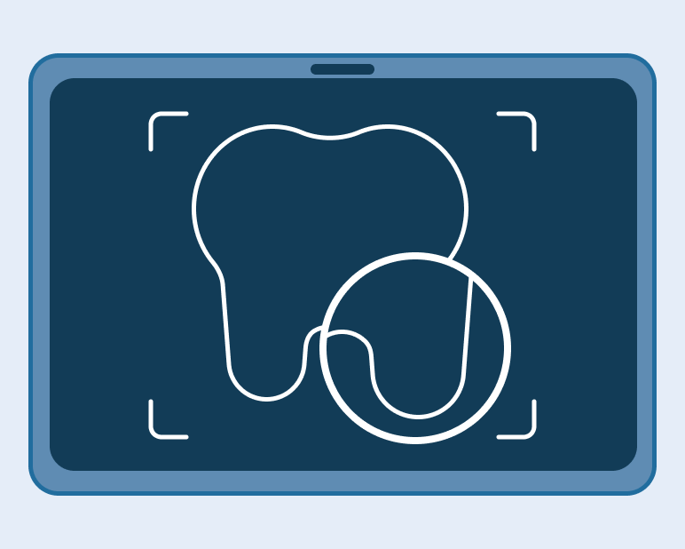alt text: Illustration of a digital dental X-ray on a tablet screen, representing the initial exam during a denture consultation.