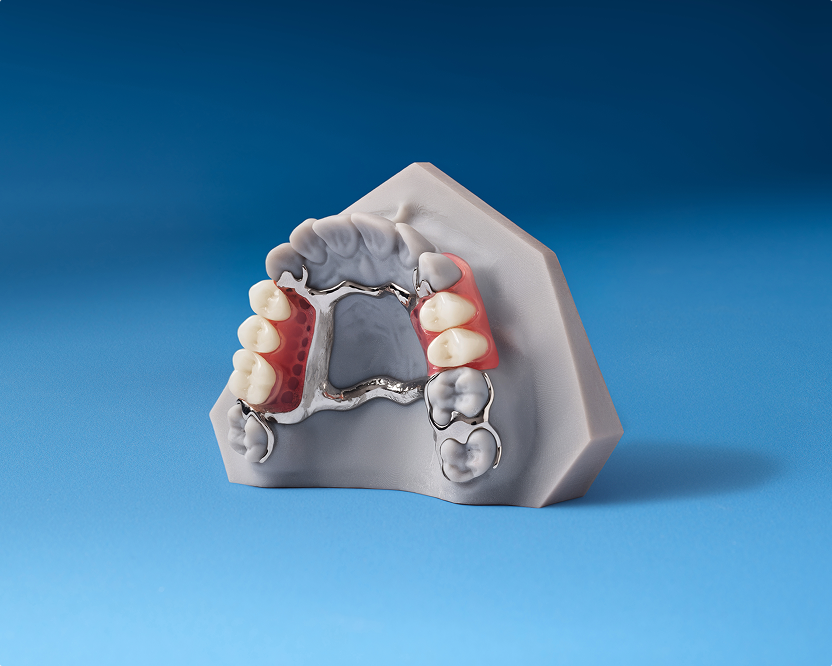 WB AD DentalServices-SpanishDesktopCard03 830x670 20260305