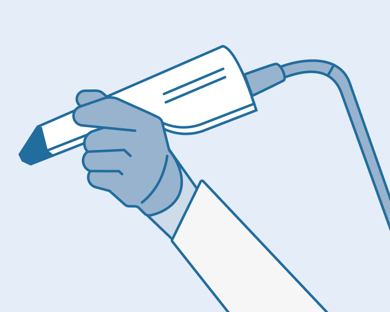 alt text: Illustration of a dentist's gloved hand holding an intraoral digital scanner, used to take precise 3D impressions for custom dentures.