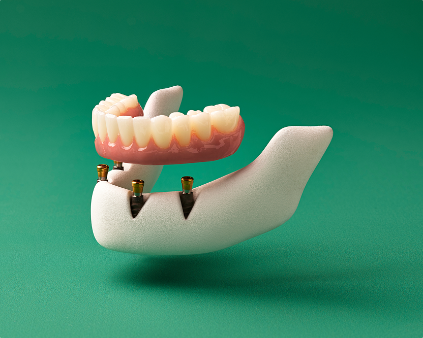 WB AD DentalServices-SpanishDesktopCard06 830x670 20260305