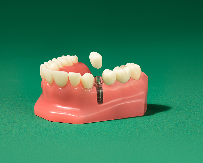 WB AD DentalServices-SpanishDesktopCard04 830x670 20260305