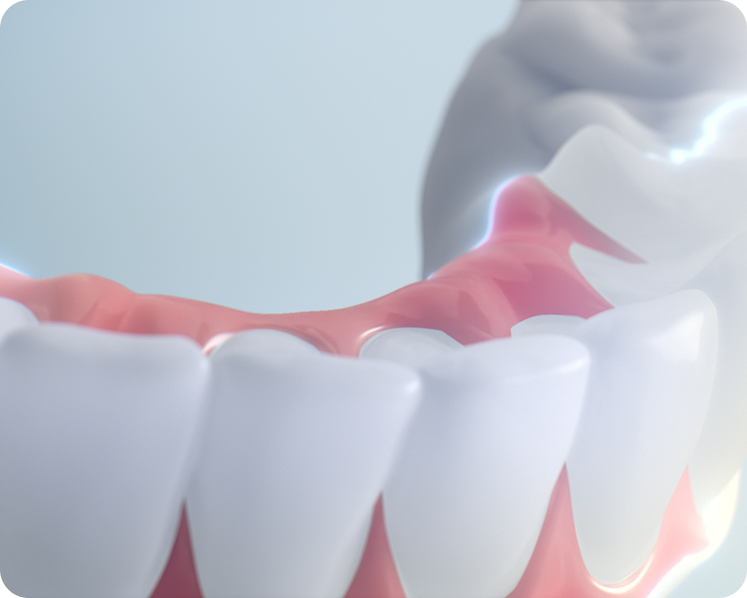Close-up detail of high-quality implant materials, highlighting the realistic gum texture and natural tooth anatomy.