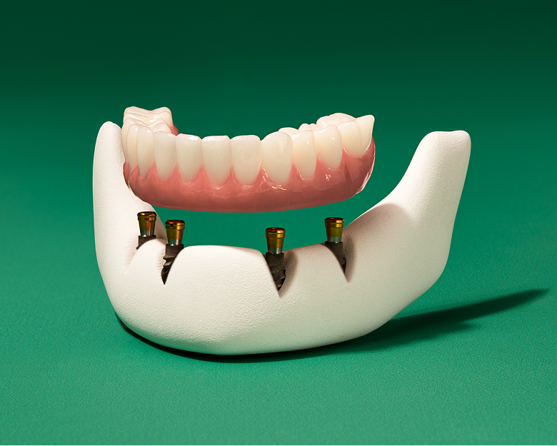 WB AD OnixFixedTraditionalPdpMobileCarousel03 780x630 20260221