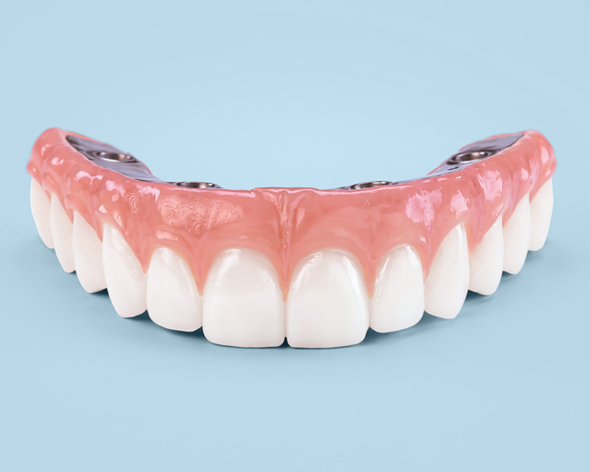 Angled view of a dental arch showing the secure implant connection points
