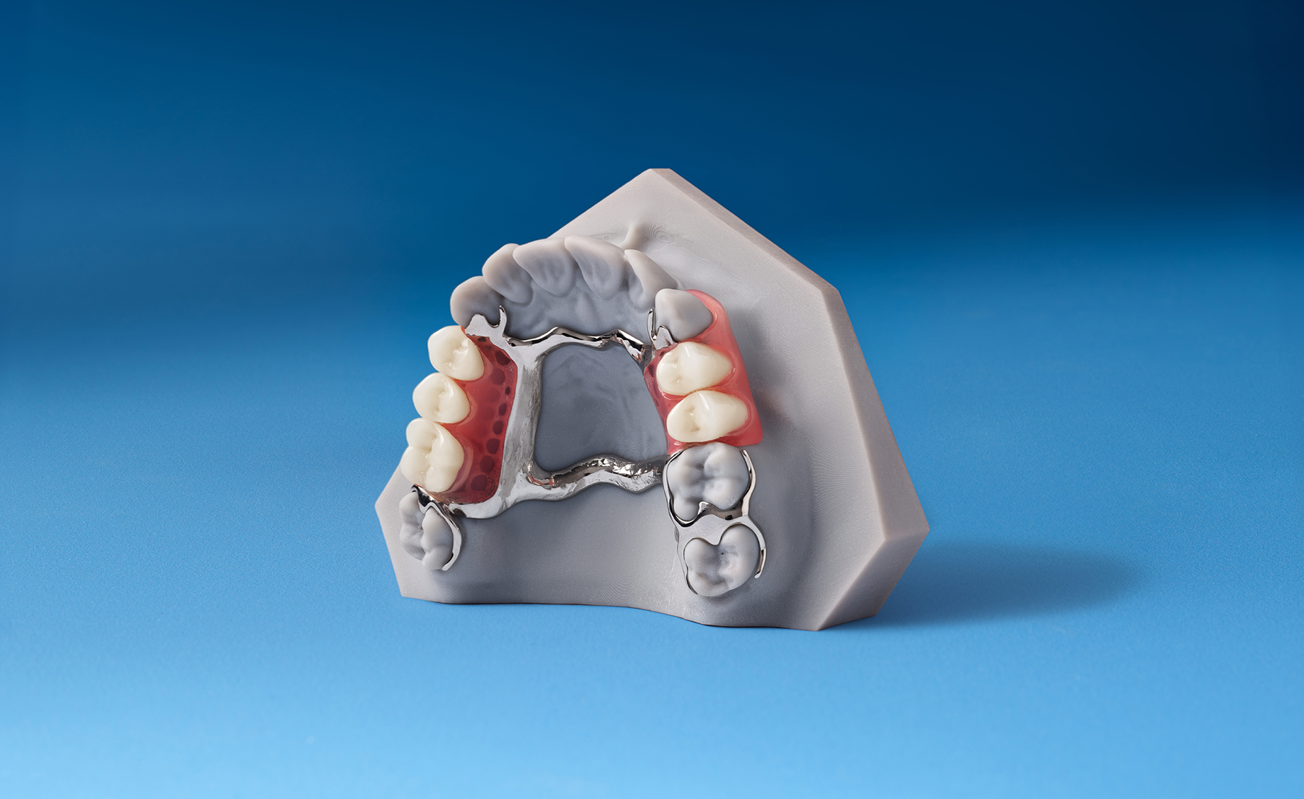Upper partial denture model with metal framework and pink acrylic base displayed on a blue background.