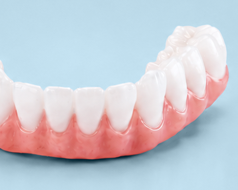 Close-up of precision-crafted front teeth on the Endura zirconia arch