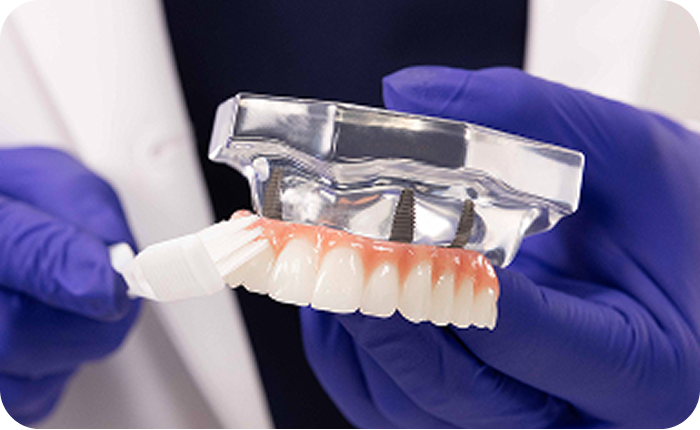 Alt text:
Dental professional cleaning a fixed full arch dental implant model.