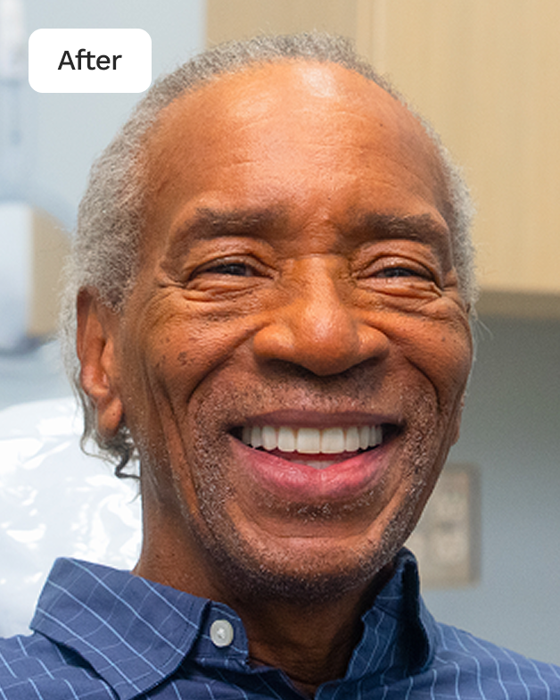 WB AD SignatureEliteDentures After 20260123