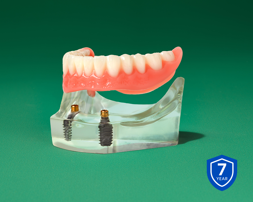 Alt text:
Implant-supported denture model displayed above dental implants with a 7-year warranty badge.