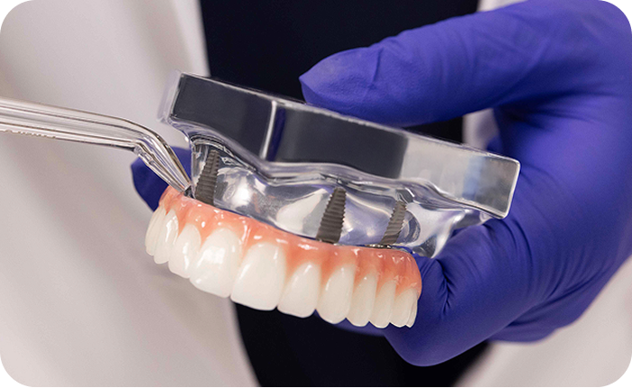 Alt text:
Dental professional flossing a fixed full arch dental implant model.