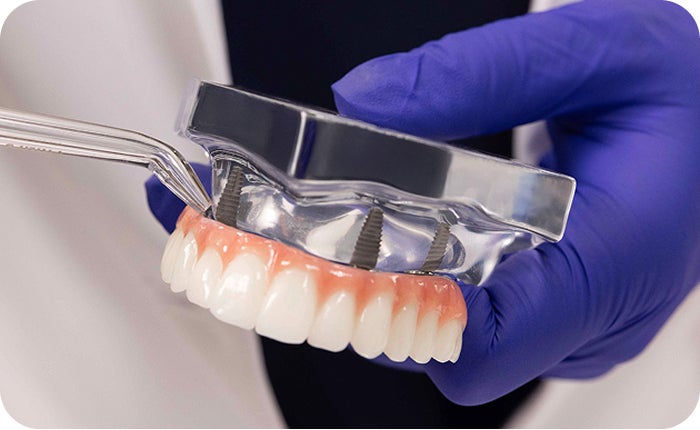 Dental professional flossing a fixed full arch dental implant model.
