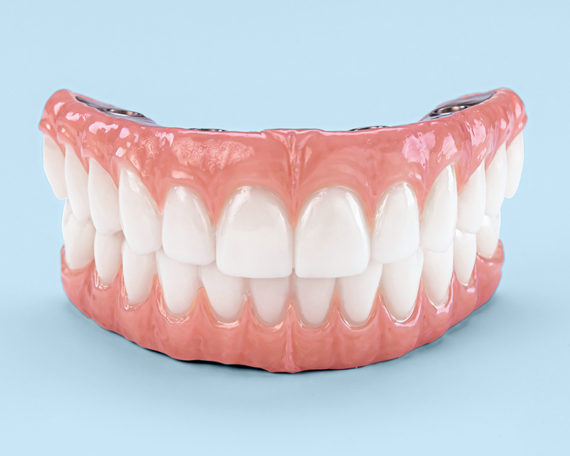 Front view of a ClearChoice full arch dental implant