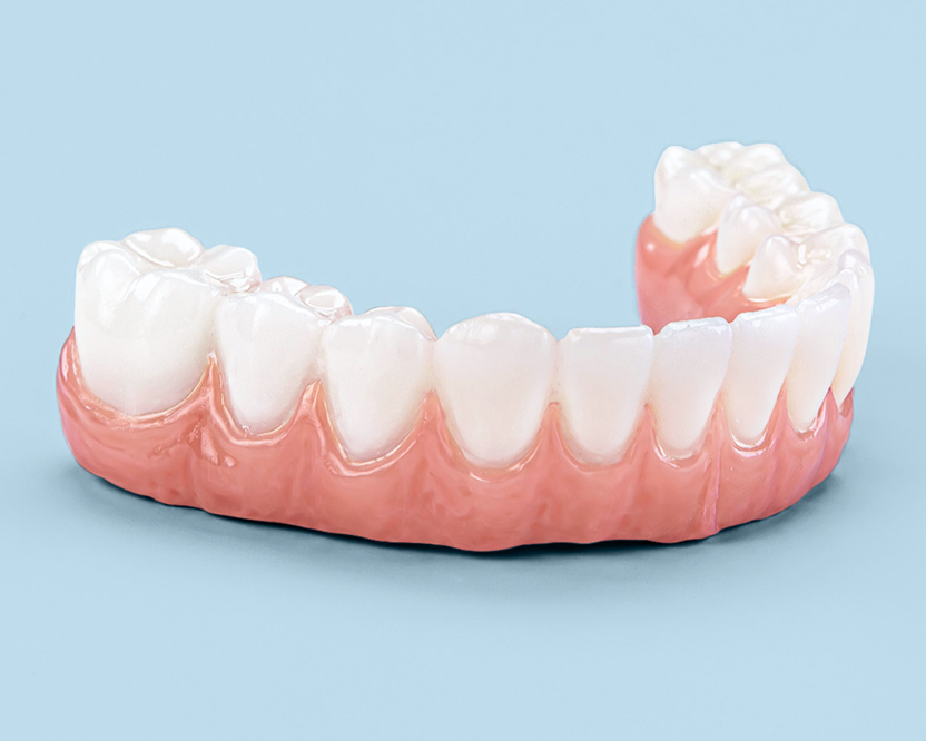 Angled view of a custom dental arch showing natural tooth alignment