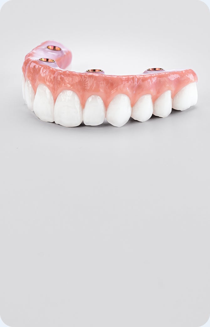 full arch dental implant prosthesis with natural-looking teeth and multiple implant connection points, representing premium elite full mouth dental implant solution