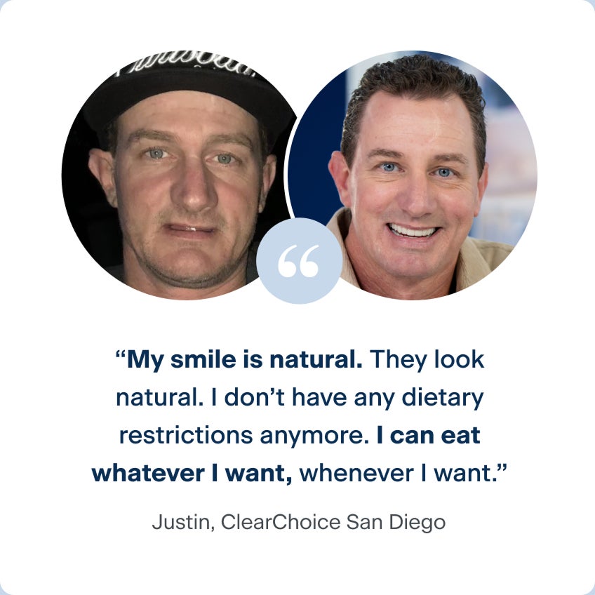 Images of Justin before and after receiving his dental implants, with his quote to describe his experience with ClearChoice: My smile is natural. They look natural. I don't have any dietary restrictions anymore. I can eat whatever I want, whenever I want.